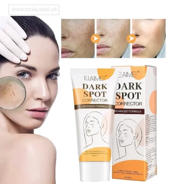 Dark Spot Whitening Cream In Pakistan